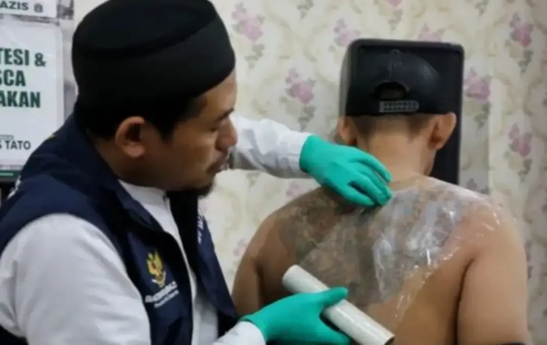 Hapus Tato Gratis Keliling Jakarta, Warga Jakbar Kebagian Giliran 24 Februari Hapus tato